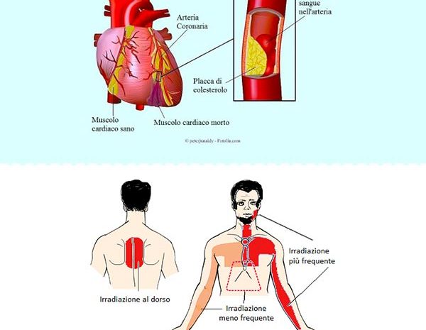 cardiochirurgia - di bari dottore